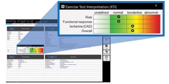 Ergebnisansicht mit der Exercise Test Interpretation (XTI)
