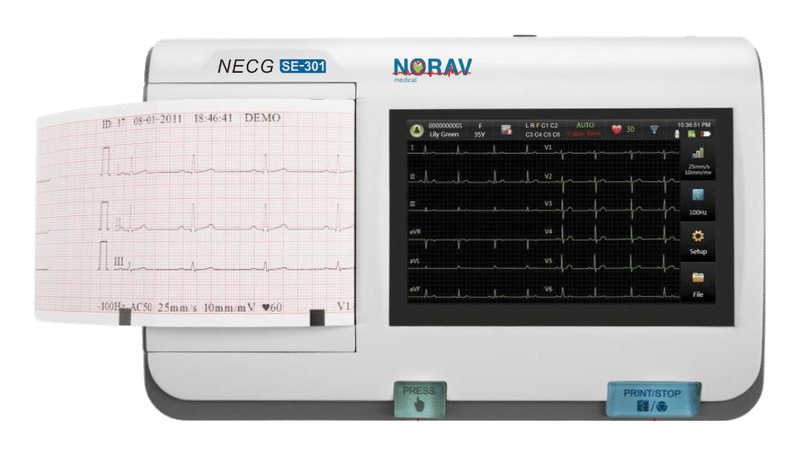 Tragbares EKG-Gerät NECG SE-301 mit Thermodrucker