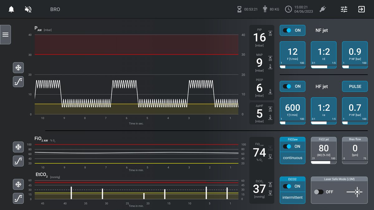 Bedienoberfläche des TwinStream EVO mit Druckkurven der superponierten Jet-Ventilation, FiO2 und etCO2 von 37 mmHg